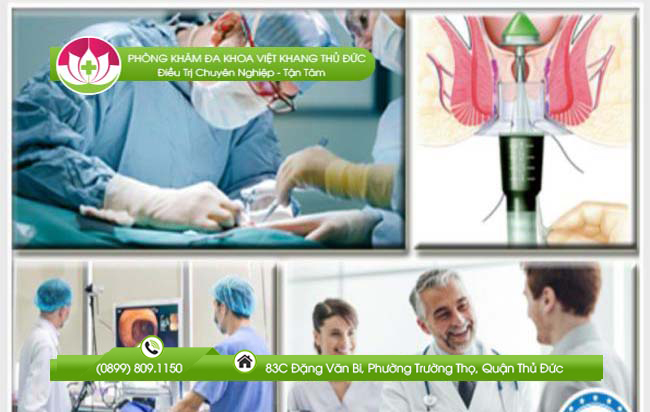 Mổ trĩ Longo phẫu thuật Ưu, nhược điểm cần biết