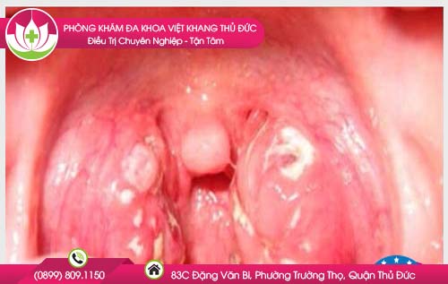amidam-co-dom-trang