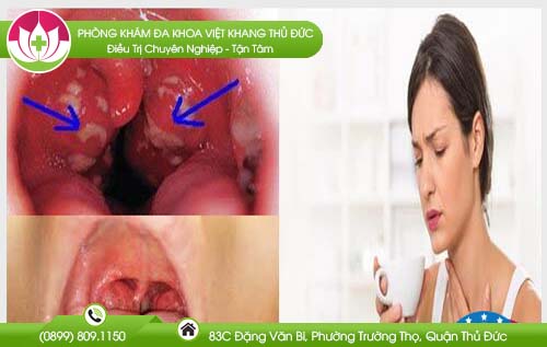 Amidam có đốm trắng có phải dấu hiệu đáng lo ngại và có thể tự chữa?