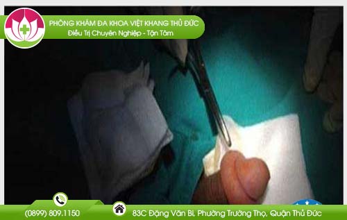 bao-quy-dau-bi-sung-sau-khi-quan-he