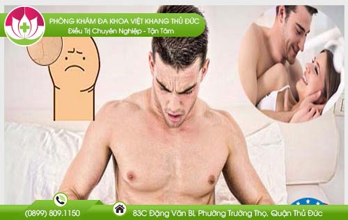 Bao quy đầu bị sưng sau khi quan hệ là bị gì?