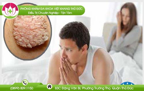 Mắc bệnh sùi mào gà có được quan hệ không? Cách quan hệ an toàn