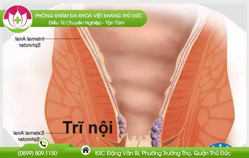 benh-tri-co-lay-khong1