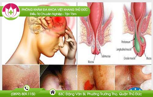 benh-tri-co-nguy-hiem-khong