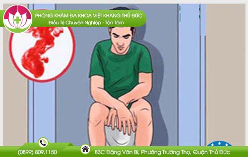 Bệnh trĩ có nguy hiểm không?