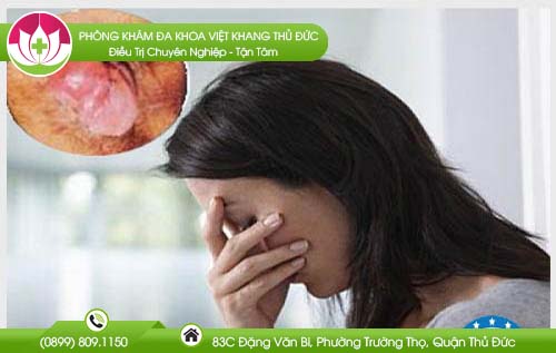 Bệnh trĩ có nguy hiểm không? Biến chứng của bệnh