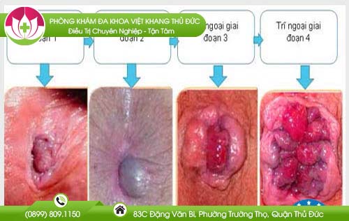 benh-vien-chua-benh-tri-quan-6