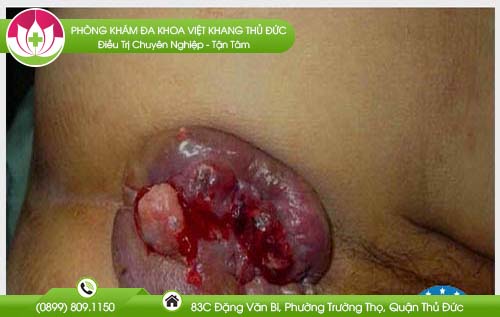 benh-vien-chua-benh-tri-quan-6