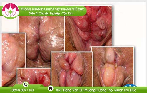 bi-loi-tri-phai-lam-sao1