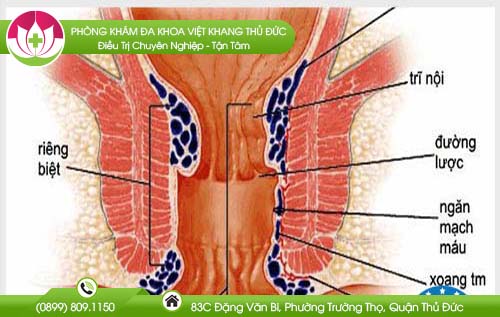bi-tri-nhung-khong-dau-khong-chay-mau-co-can-chua-khong