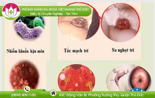 Các biến chứng của bệnh trĩ nguy hiểm như thế nào?