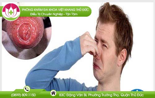 Tìm hiểu bộ phận sinh dục nam có mùi hôi do đâu và cách xử lý hiệu quả