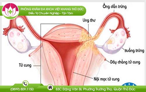 cac-benh-phu-khoa-nguy-hiem