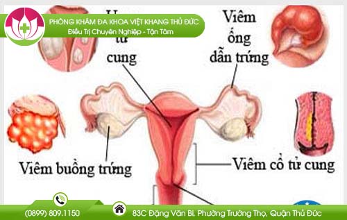 Các bệnh phụ khoa nguy hiểm mà hội chị em cần biết