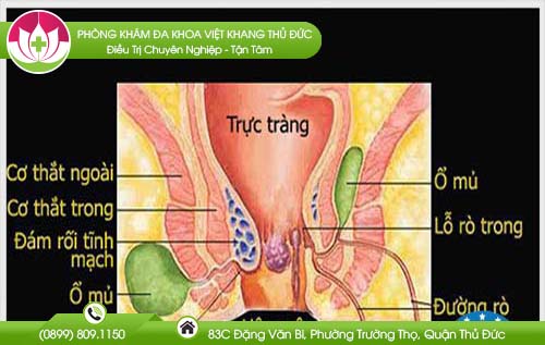 cach-chua-benh-mach-luon-bang-dong-y1