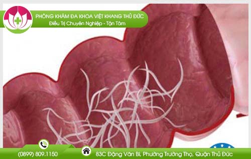 cach-chua-giun-kim-cho-tre