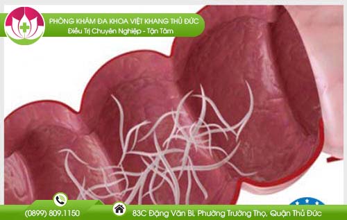 Cách chữa giun kim cho trẻ