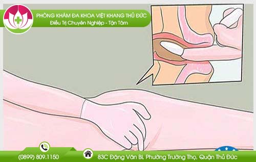 cach-dung-thuoc-dat-hau-mon-cho-nguoi-bi-benh-tri