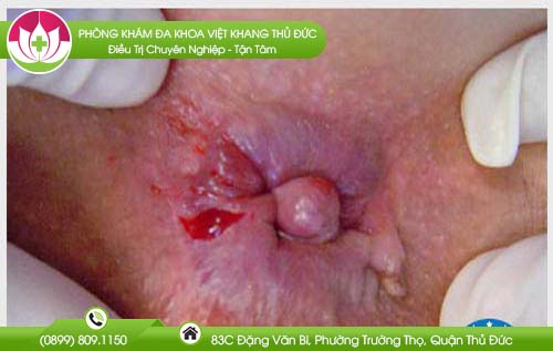 cach-nhan-biet-benh-tri-nang-nhe-nhu-the-nao