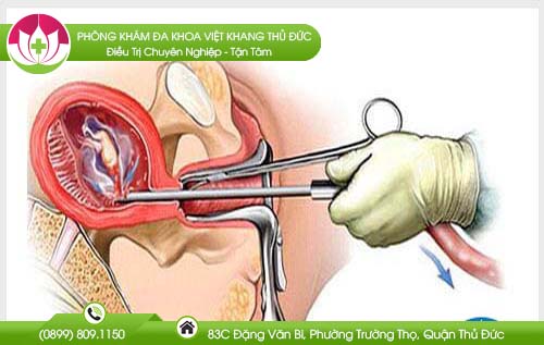 cach-pha-thai-trong-thang-dau-tien