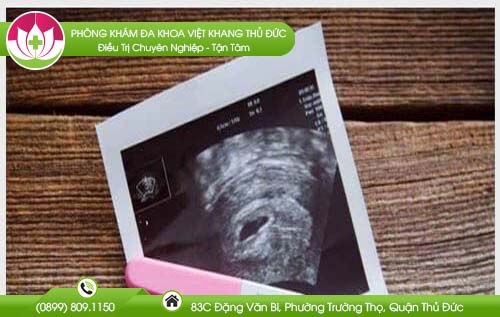 cach-thu-thai-chinh-xac-nhat