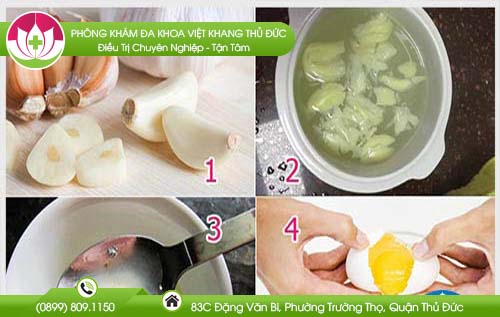 Cách trị giun kim bằng tỏi