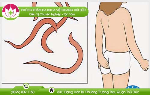 cach-tri-giun-kim-bang-toi1