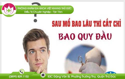 Sau tiểu phẫu bao lâu thì cắt chỉ bao quy đầu?