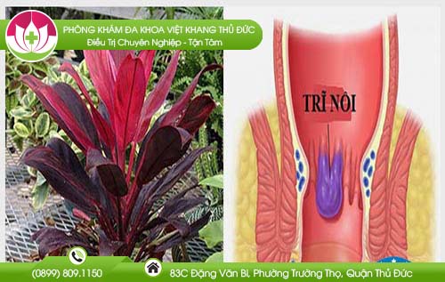 Cây huyết dụ có chữa được bệnh trĩ không?