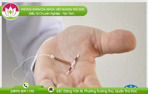 chi-phi-dat-vong-tranh-thai