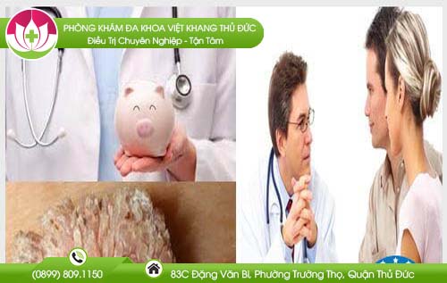 chua-benh-sui-mao-ga-co-dat-khong