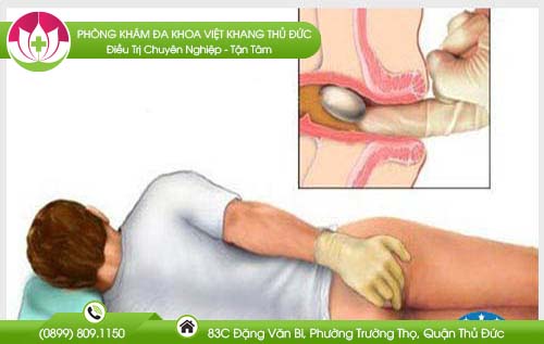 chua-benh-tri-o-benh-vien-nao-tai-tphcm