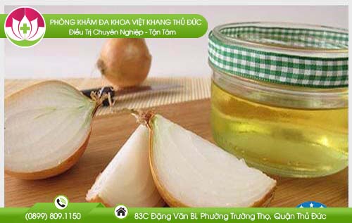 chua-mun-coc-sinh-duc-tai-nha