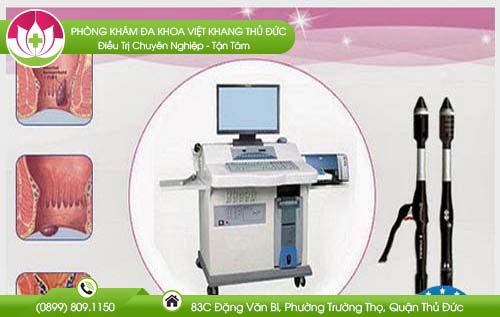 chua-ro-hau-mon-bang-cach-phau-thuat