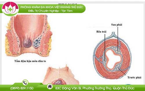chua-tri-noi-bang-rau-diep-ca-co-duoc-khong1