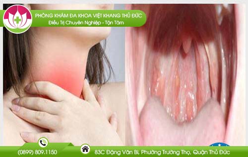 Cổ họng bị lở và cách hỗ trợ điều trị tốt nhất - Bệnh viện tai mũi họng