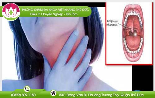 co-hong-nhieu-chat-nhay