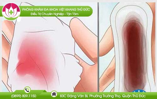 co-kinh-co-mang-thai-duoc-khong