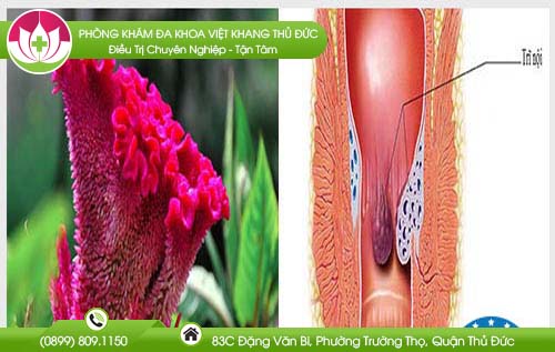 Công dụng của cây mào gà với bệnh trĩ