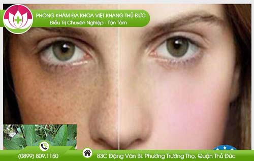 cong-dung-cua-cay-mat-gau-cho-ban-nhieu-bat-ngo