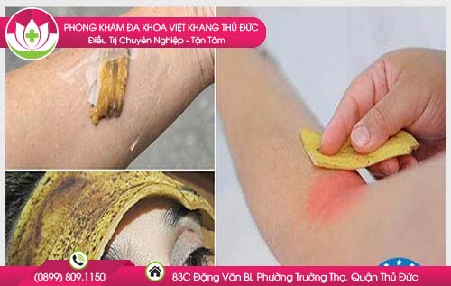 cong-dung-tu-vo-chuoi-ma-it-ai-biet-den