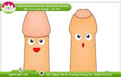 dai-bao-quy-dau-co-nen-cat-khong