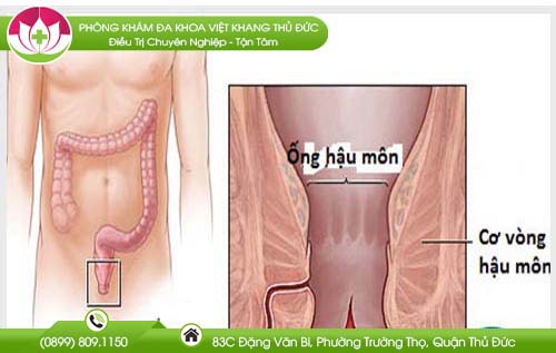 dau-hieu-bi-nut-hau-mon-va-hinh-anh-thuc-te