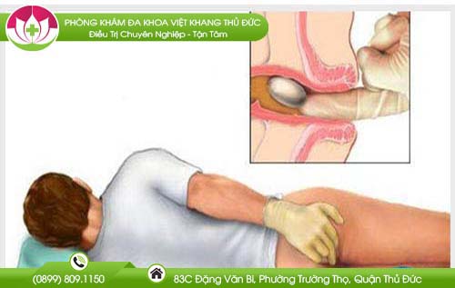 dau-hieu-cua-benh-tri-va-cach-dieu-tri