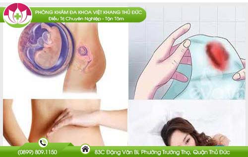 Dấu hiệu thai bị lưu 3 tháng đầu chuẩn xác mẹ chớ bỏ qua