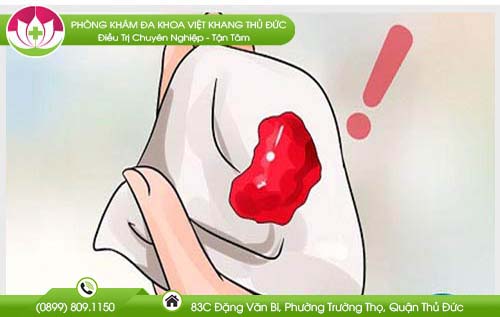 Đi cầu ra máu là dấu hiệu của bệnh gì?