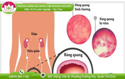 di-tieu-buot-va-ngua