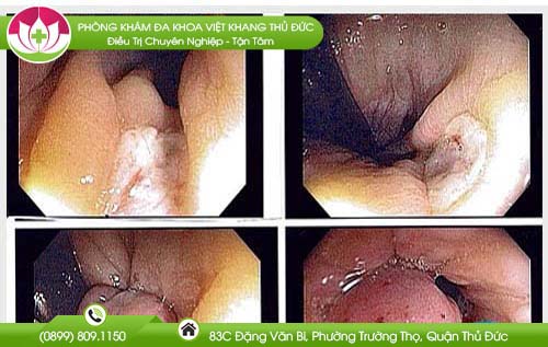 dia-chi-benh-vien-chua-benh-tri-bac-lieu