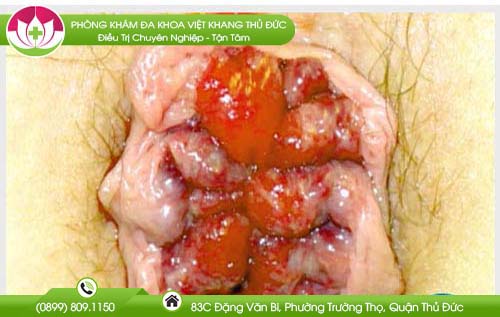 dia-chi-benh-vien-chua-benh-tri-binh-duong