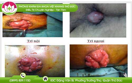 dia-chi-benh-vien-chua-benh-tri-binh-tan
